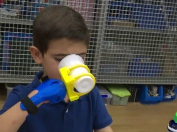  'SuperGiz', la nueva prótesis mecánica con tecnología 3D 