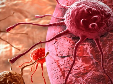 Célula cancerosa Célula cancerosa