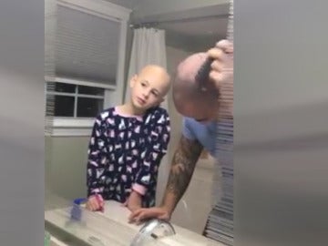 Un padre se rapa para solidarizarse con su hija con alopecia