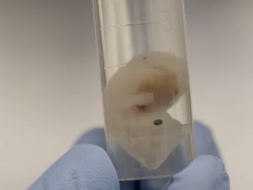 El futuro de los trasplantes en medicina: cultivar órganos humanos en embriones de animales El futuro de los trasplantes en medicina: cultivar órganos humanos en embriones de animales