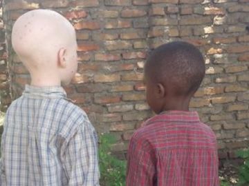 La 'caza' de los niños albinos en África La 'caza' de los niños albinos en África
