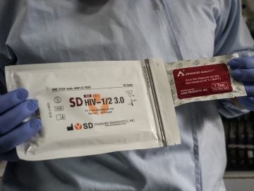 Prueba del VIH Prueba del VIH