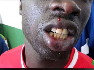 Nueva agresión racista en el fútbol español: "Me dijo que me iba a cortar las trencitas" Nueva agresión racista en el fútbol español: "Me dijo que me iba a cortar las trencitas"