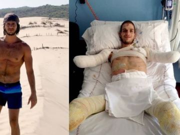 El joven Davide antes y después de ser amputado El joven Davide antes y después de ser amputado