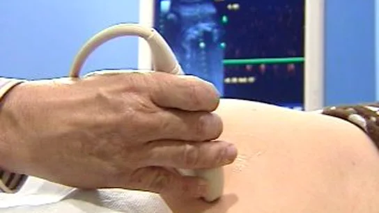 Aborto Aborto