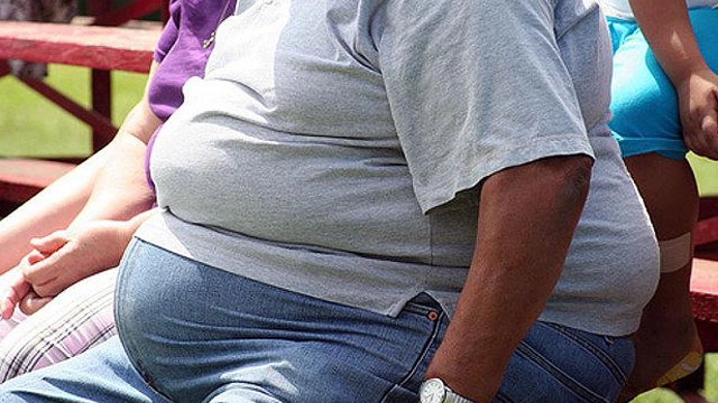 Un hombre obeso sentado en un banco Un hombre obeso sentado en un banco