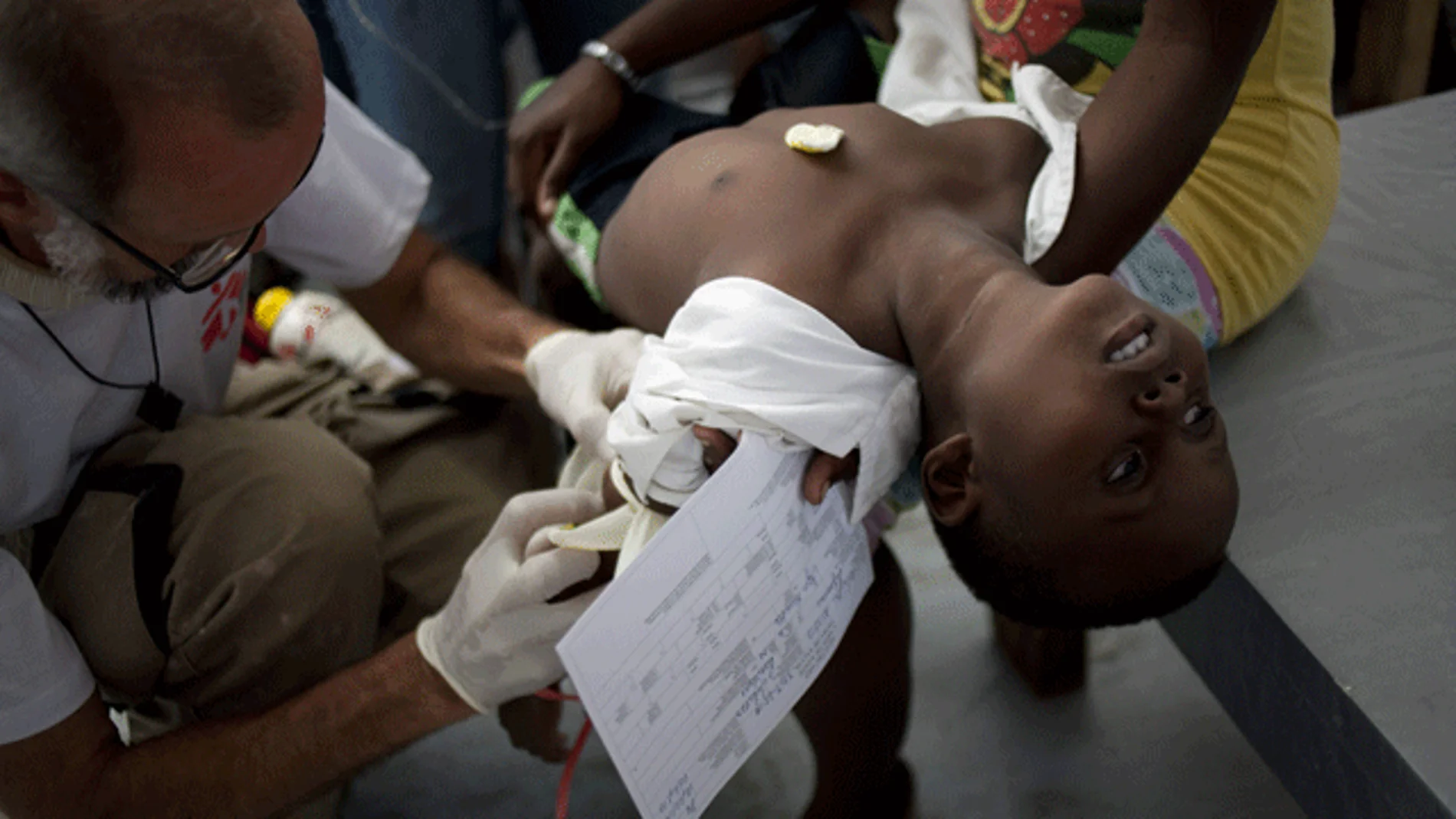 Un niño con síntomas de cólera es atendido