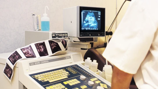 Procedimiento en una ecografía. Procedimiento en una ecografía.