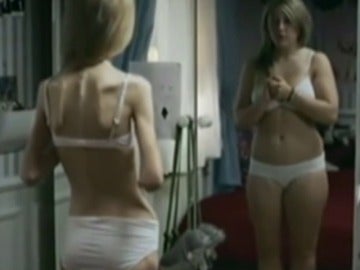 Anorexia Anorexia
