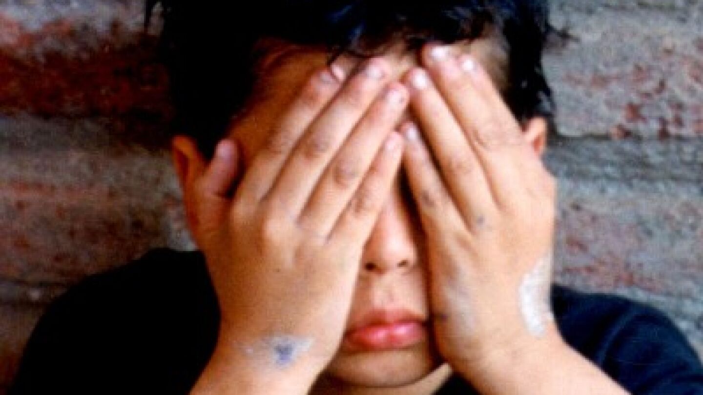 Imagen de un ni&ntilde;o v&iacute;ctima de acoso