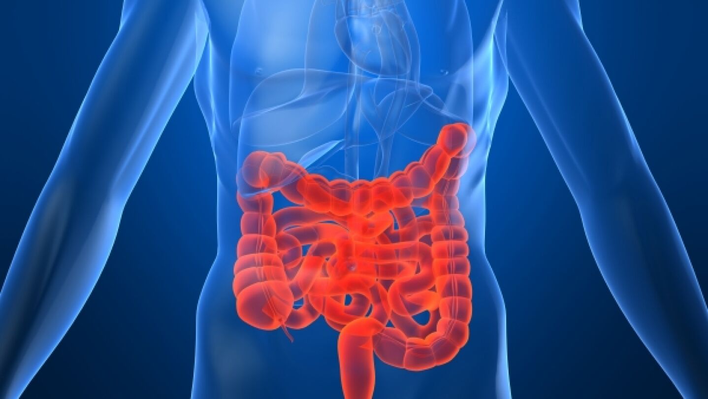 C&aacute;ncer de colon