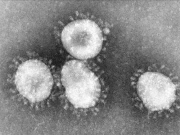 Imagen del coronavirus en el microscopio Imagen del coronavirus en el microscopio