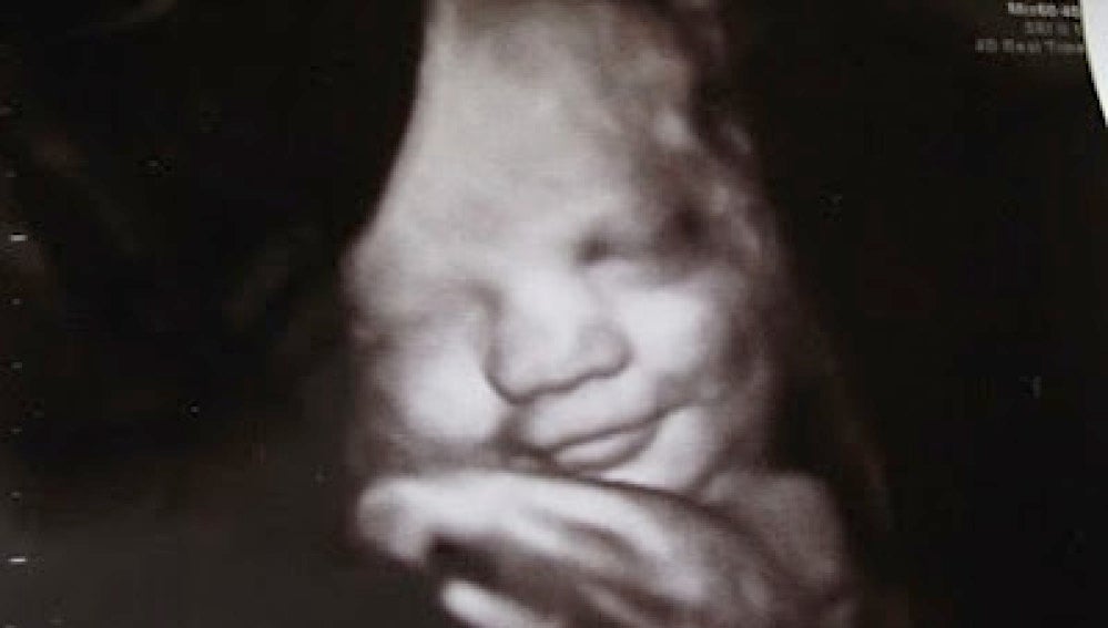 Bebé en el útero. 