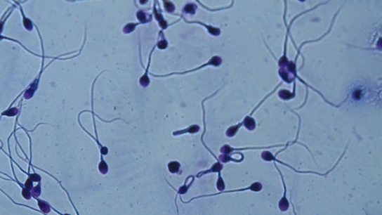 Espermatozoides Espermatozoides