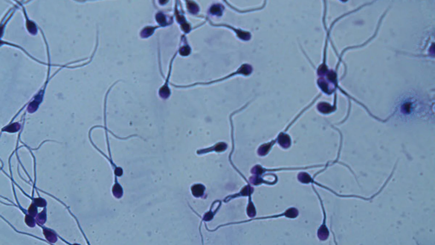 Espermatozoides Espermatozoides