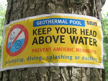 Aviso de peligro por posibles contagios de meningitis amebiana Aviso de peligro por posibles contagios de meningitis amebiana