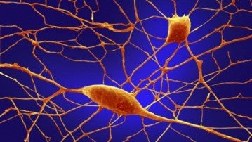 Neuronas