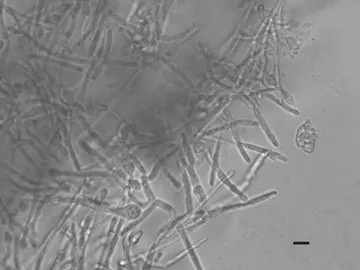 Schizosaccharomyces pombe Schizosaccharomyces pombe