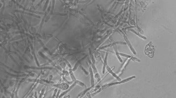 Schizosaccharomyces pombe