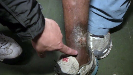 "Un m&eacute;dico atiende a los 6.500 internos"