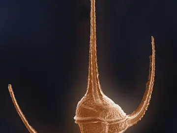 Los dinoflagelados microscópicos que causan “mareas tóxicas” son la causa más común de envenenamiento. Los dinoflagelados microscópicos que causan “mareas tóxicas” son la causa más común de envenenamiento.