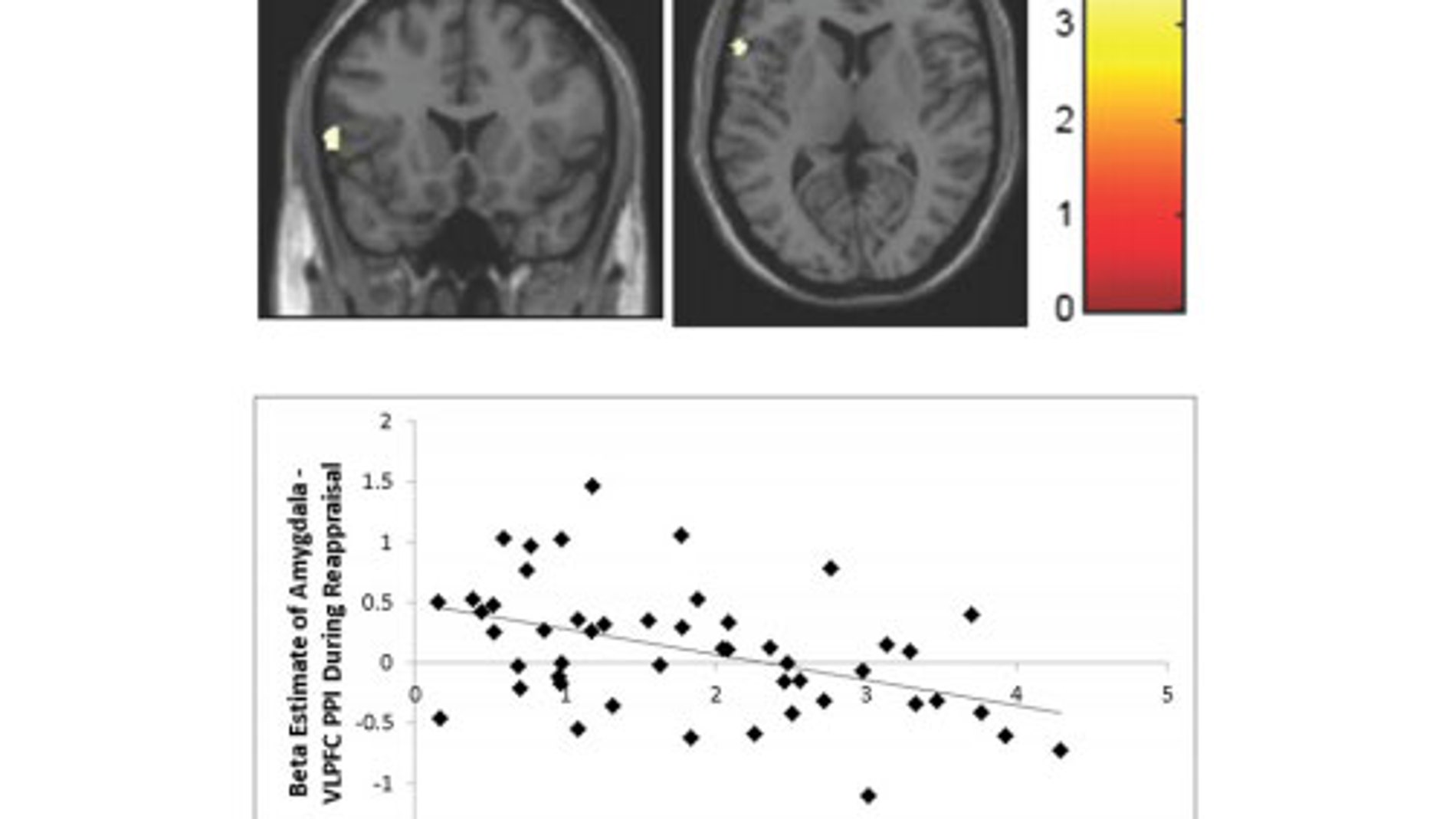 Escáneres cerebrales que prueban los efectos de la pobreza infantil en el cerebro