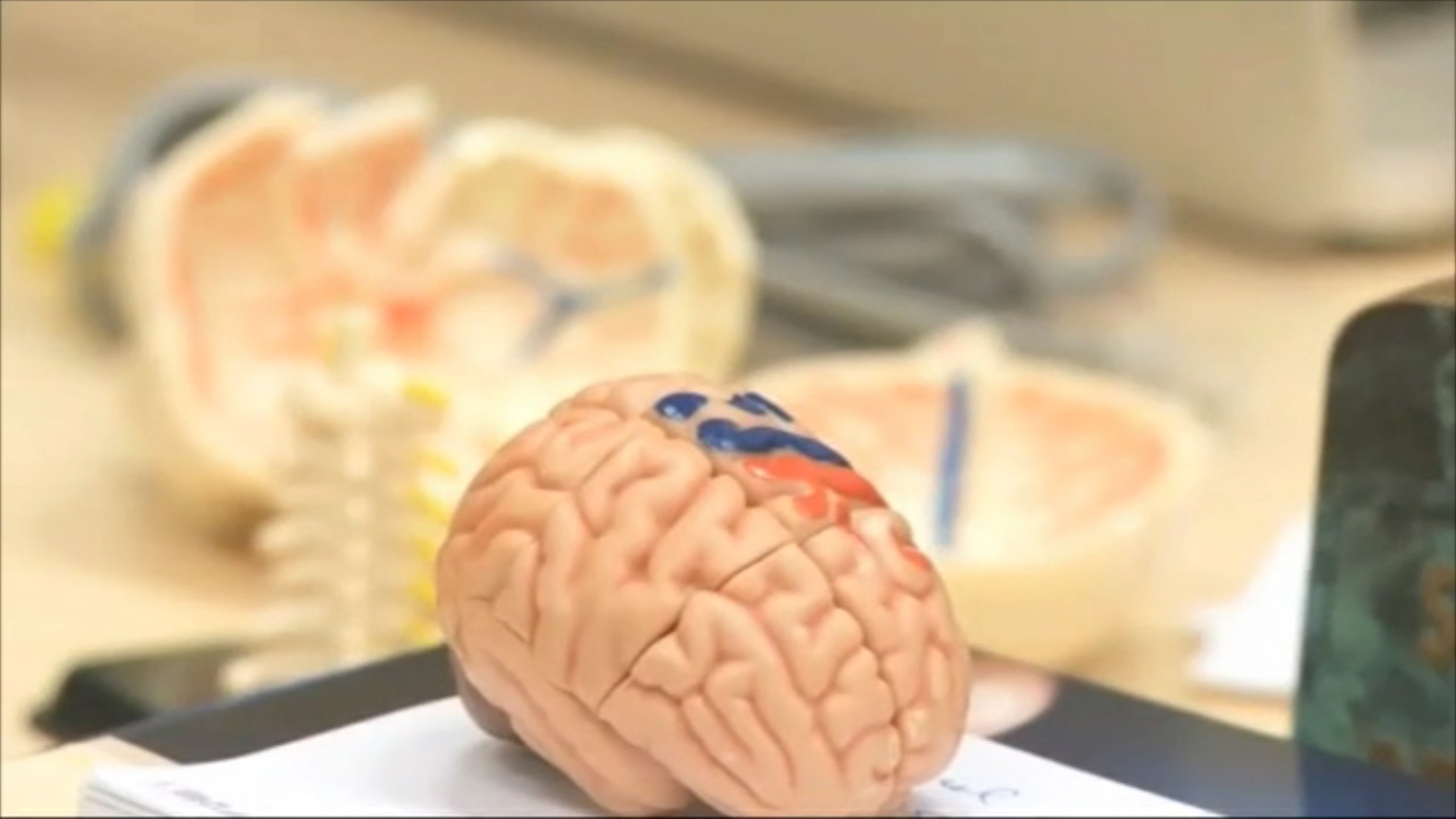 Cerebro