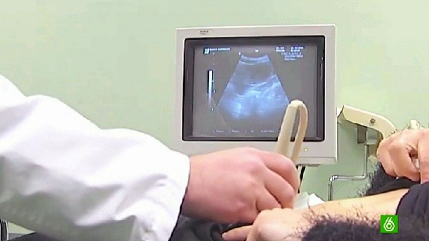 aborto