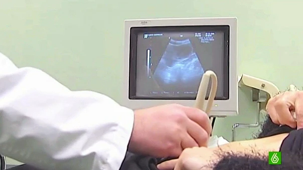 aborto aborto