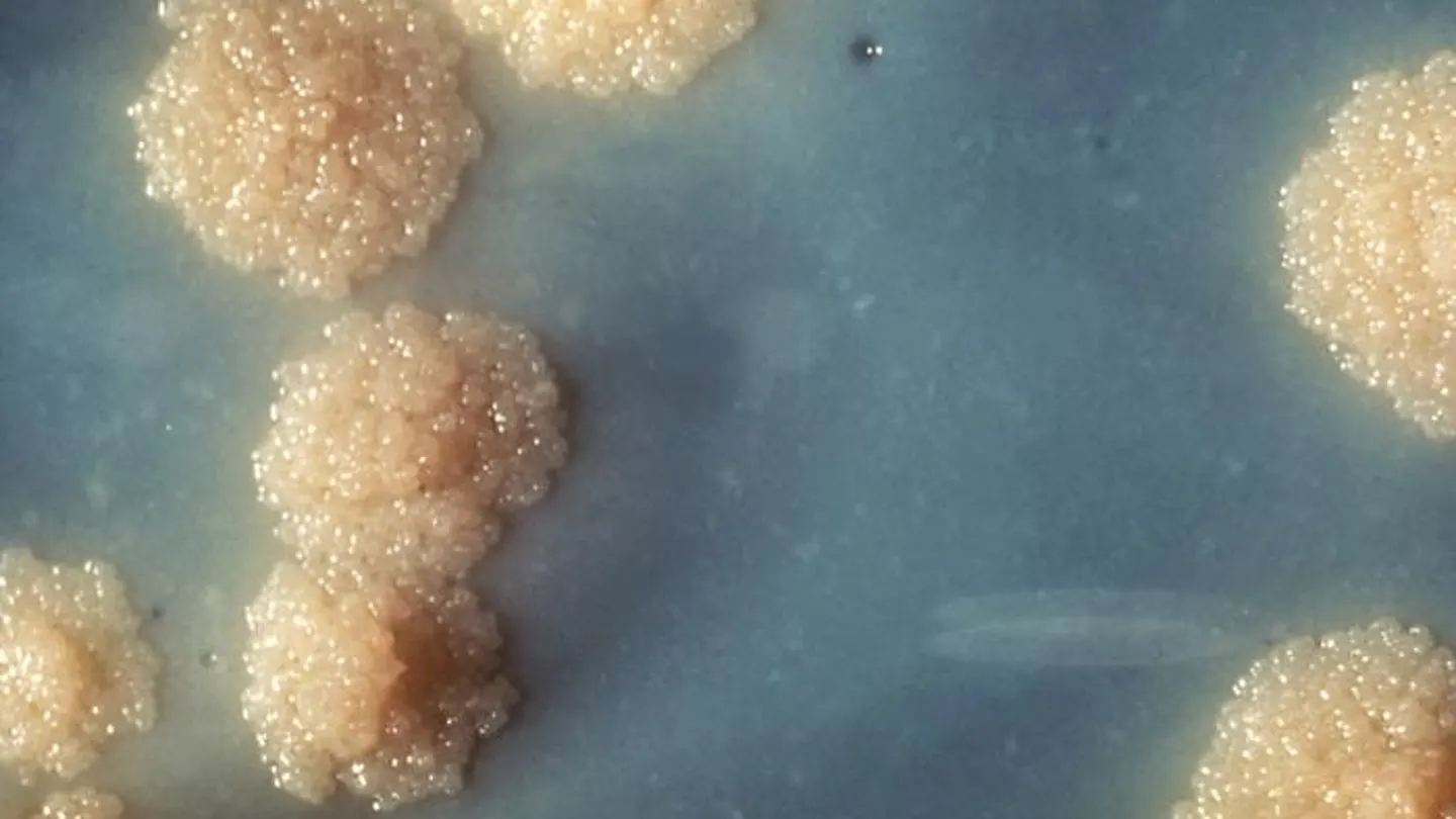 Tuberculosis Tuberculosis