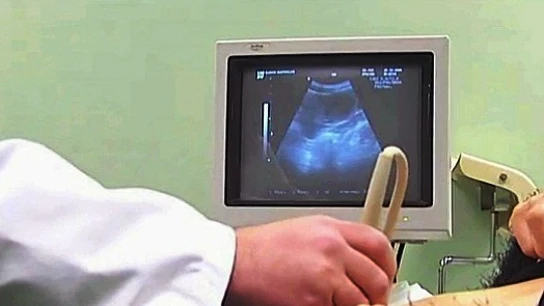 Un médico realiza una ecografía Un médico realiza una ecografía