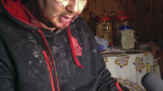Activista Dmitro Bulat&oacute;v, encontrado malherido 