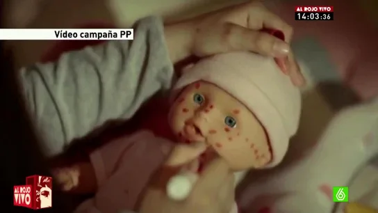 Muñeca con sarampión Muñeca con sarampión