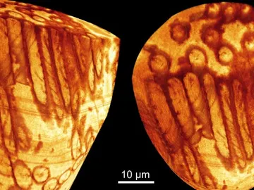 Así luce un esperma gigante después de 17 millones de años Así luce un esperma gigante después de 17 millones de años