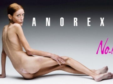  Isabelle Caro, la modelo francesa famosa por su anorexia y que murió en 2010