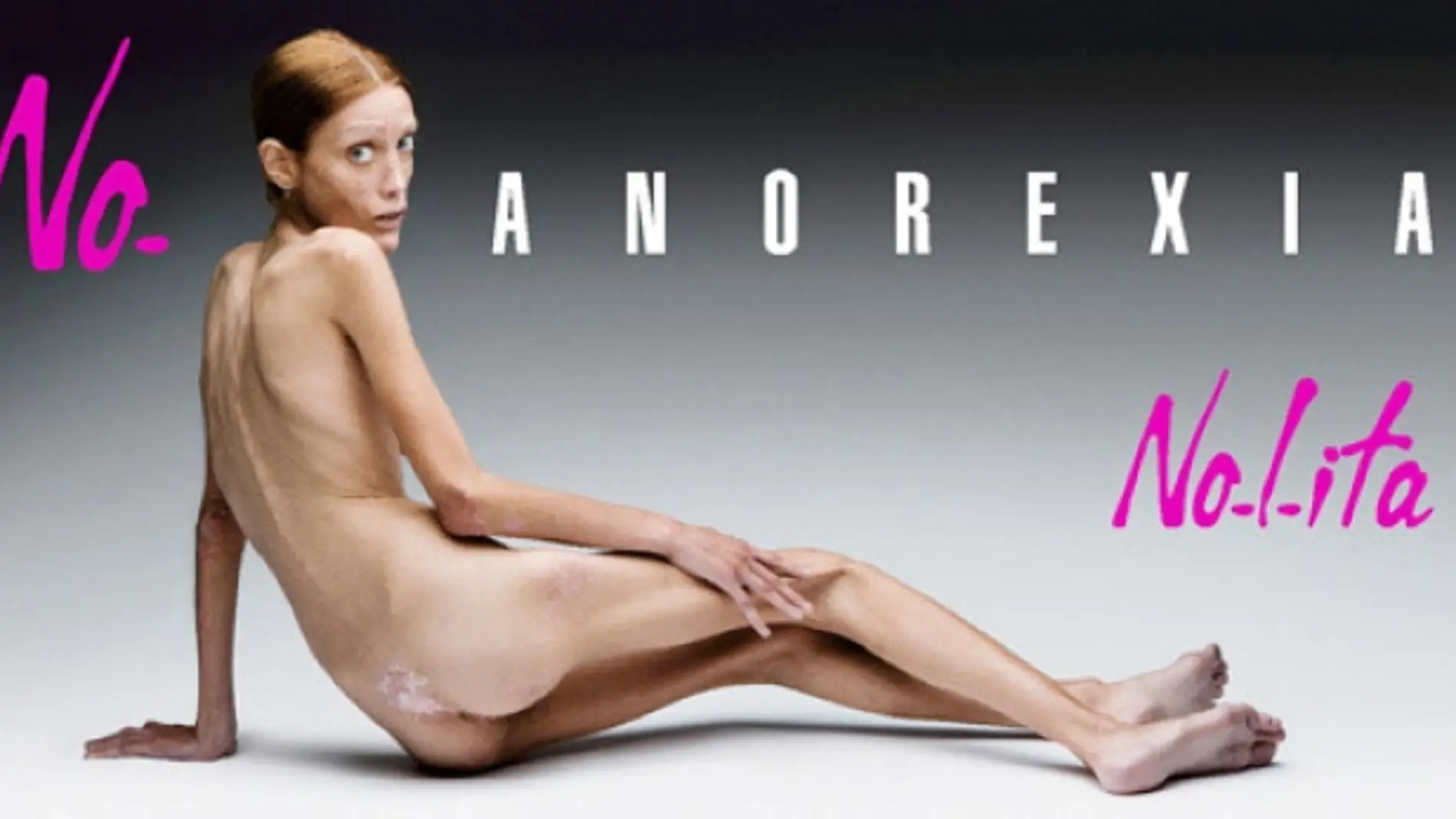  Isabelle Caro, la modelo francesa famosa por su anorexia y que murió en 2010