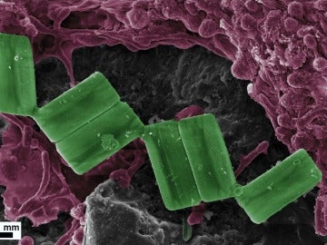 Diatomeas y bacterias comedoras de plásticos