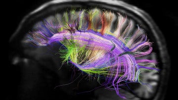 Recreación de algunas conexiones cerebra