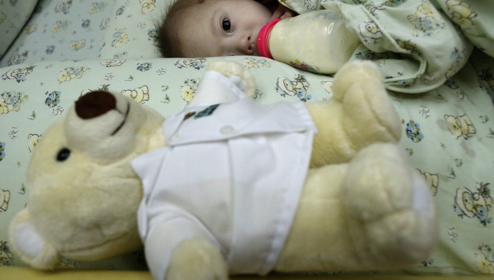 Gammy o Naruebet Mincharoen, un bebé de 7 meses con síndrome de Down