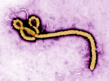 Virus ébola Virus ébola
