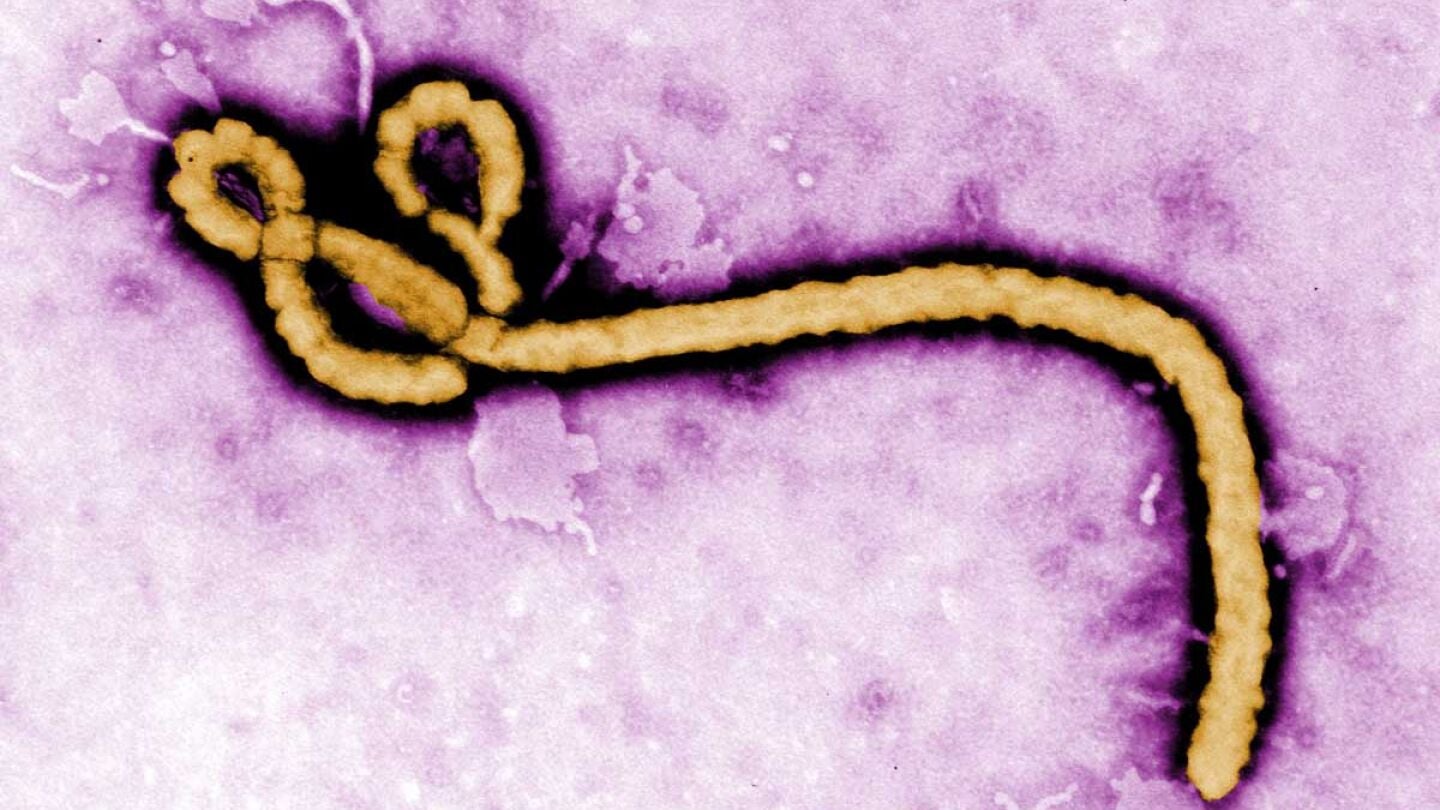 Virus &eacute;bola