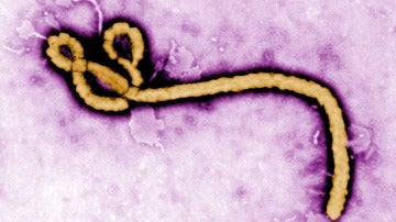 Virus ébola