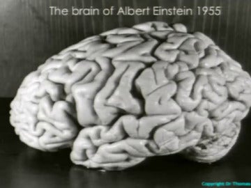 Cerebro de Einstein