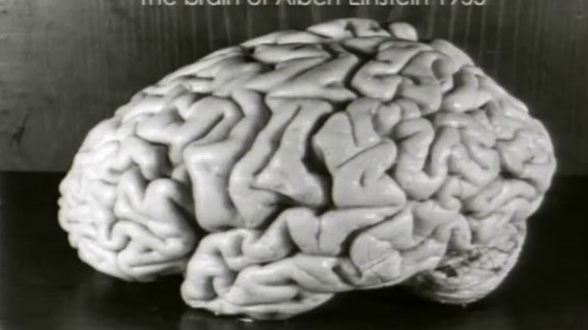 Cerebro de Einstein