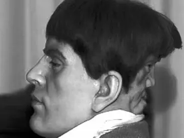 Edward Mordrake Edward Mordrake