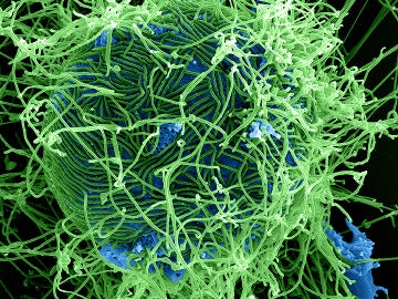 Virus del Ébola