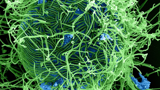 Virus del Ébola Virus del Ébola