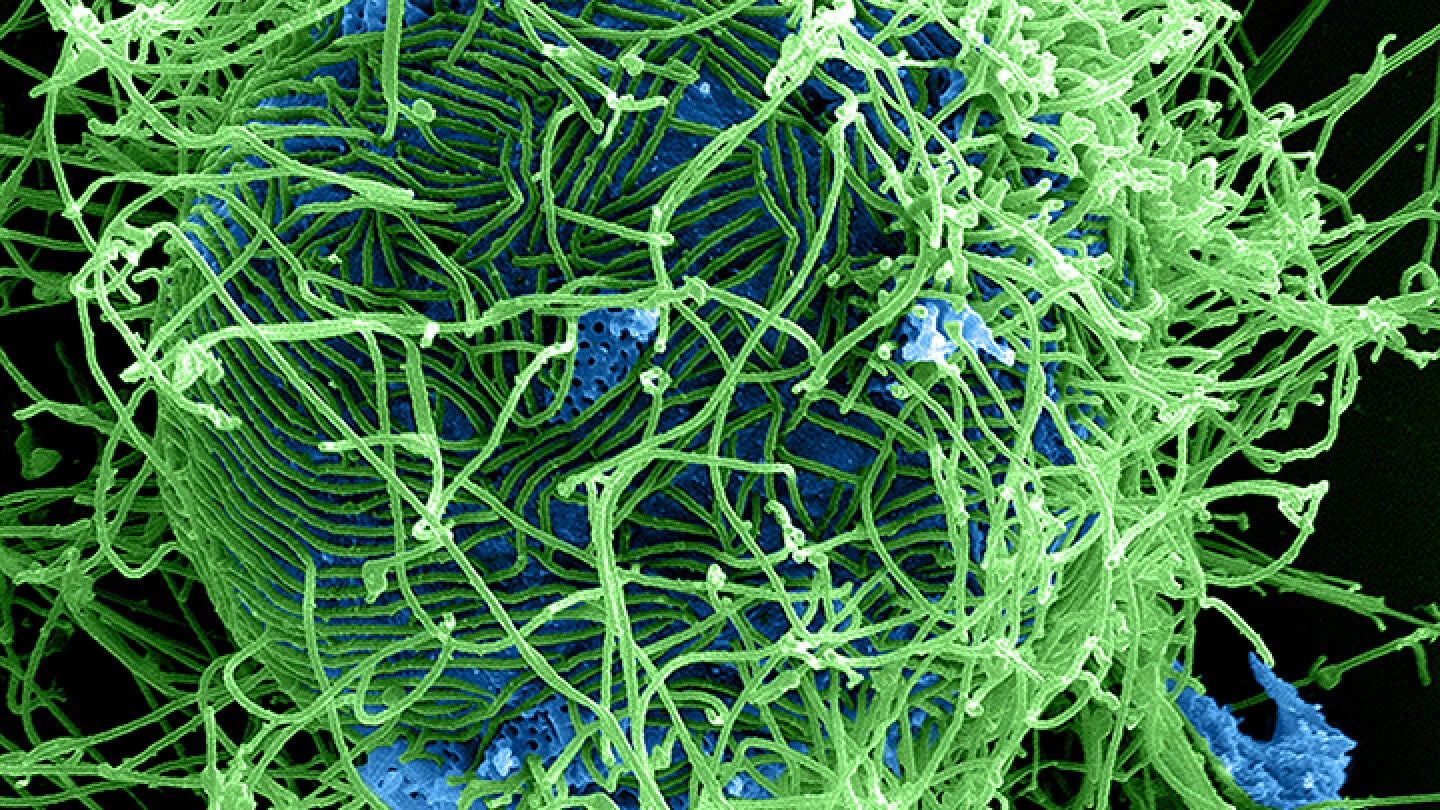 Virus del &Eacute;bola