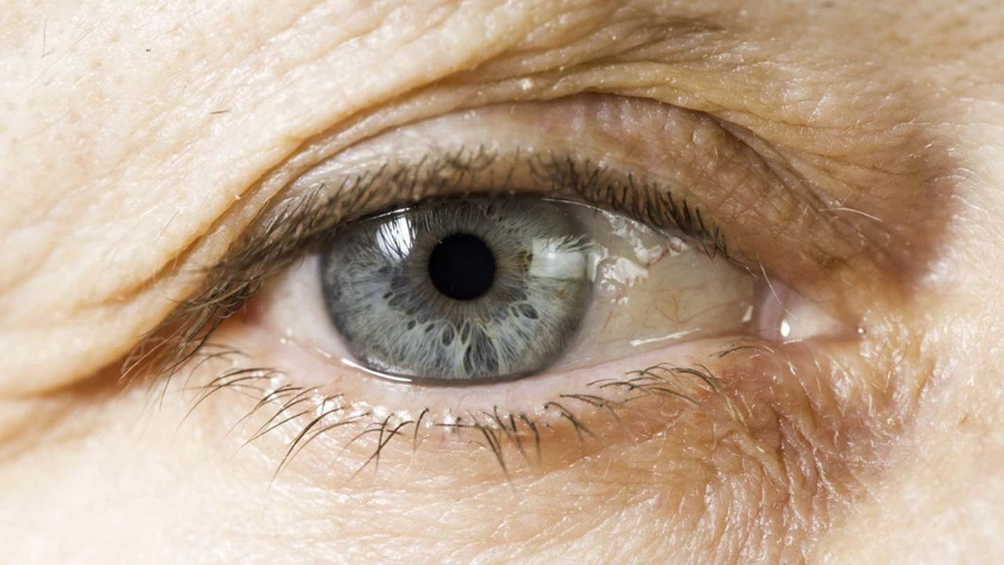 Imagen de un ojo Imagen de un ojo