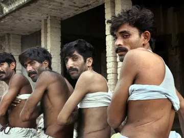 Cuatro jornaleros pakistaníes secuestrados y obligados a donar muestran cicatrices Cuatro jornaleros pakistaníes secuestrados y obligados a donar muestran cicatrices